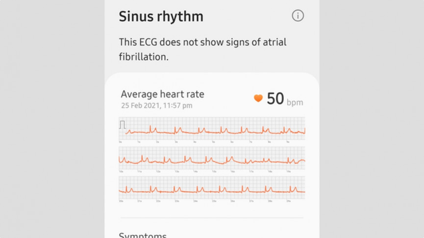 How to take an ECG reading on the Samsung Galaxy smartwatches