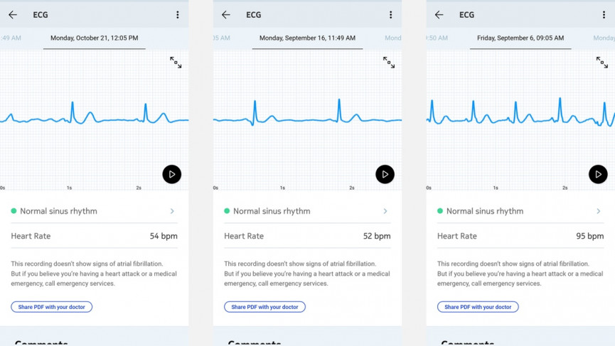 Withings Move ECG review